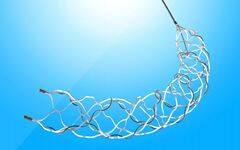 中天医疗：高品质器械服务1300万脑卒中患者，带动神经介入市场下沉【神经介入专题】