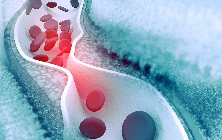 国内神经介入市场，未来谁主沉浮？
