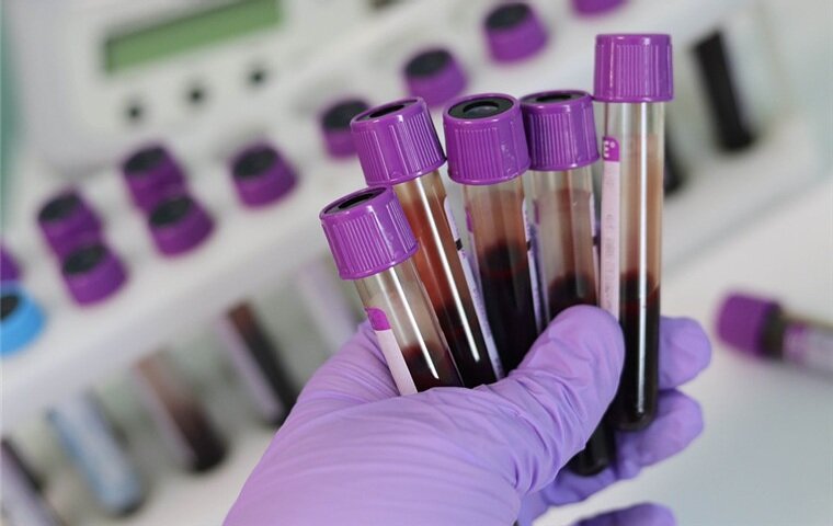 罕见病基因治疗市场走热，诺华、辉瑞、蓝鸟、 Spark、博雅辑因……16家基因治疗公司如何布局？